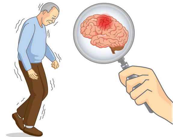 脑卒中-康复-持久战-呼吸训练-介入-呼吸训练器-肺功能-肺功能检测仪-肺通气指标-肺活量-中风-脑出血-肺部疾病-肺炎-吸气肌-呼吸肌-呼吸操